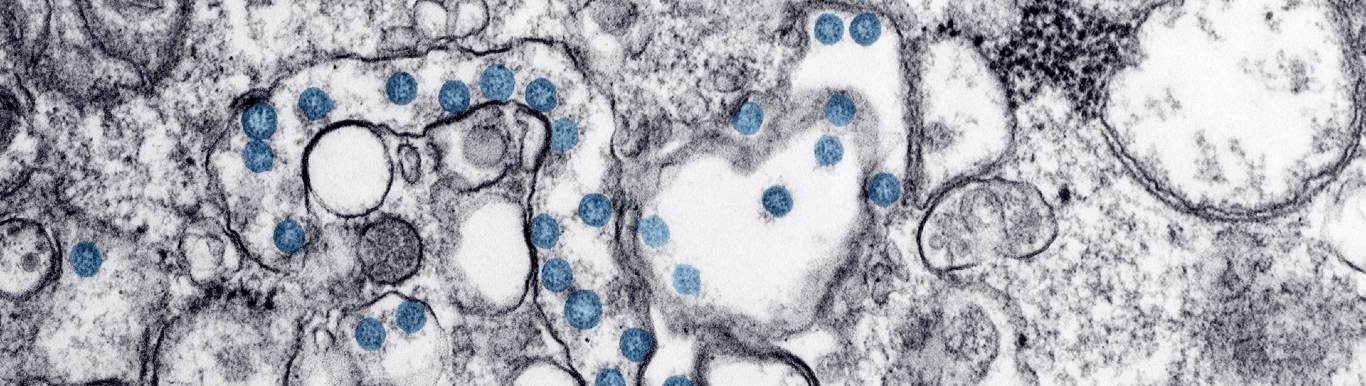coronavirus